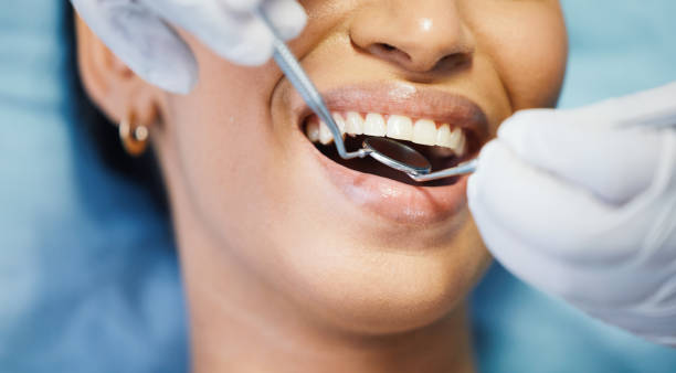 Best Urgent Dental Care for Toothaches in Burlington, VT